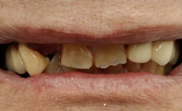 ANTES Angela Otero (1)