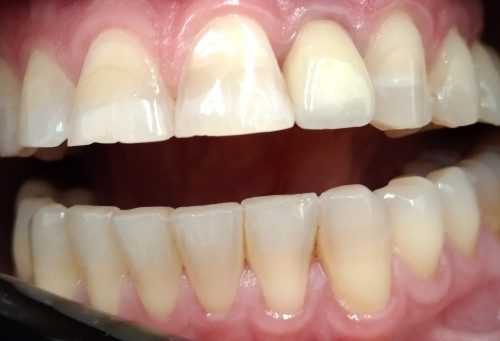 después carolina (1)